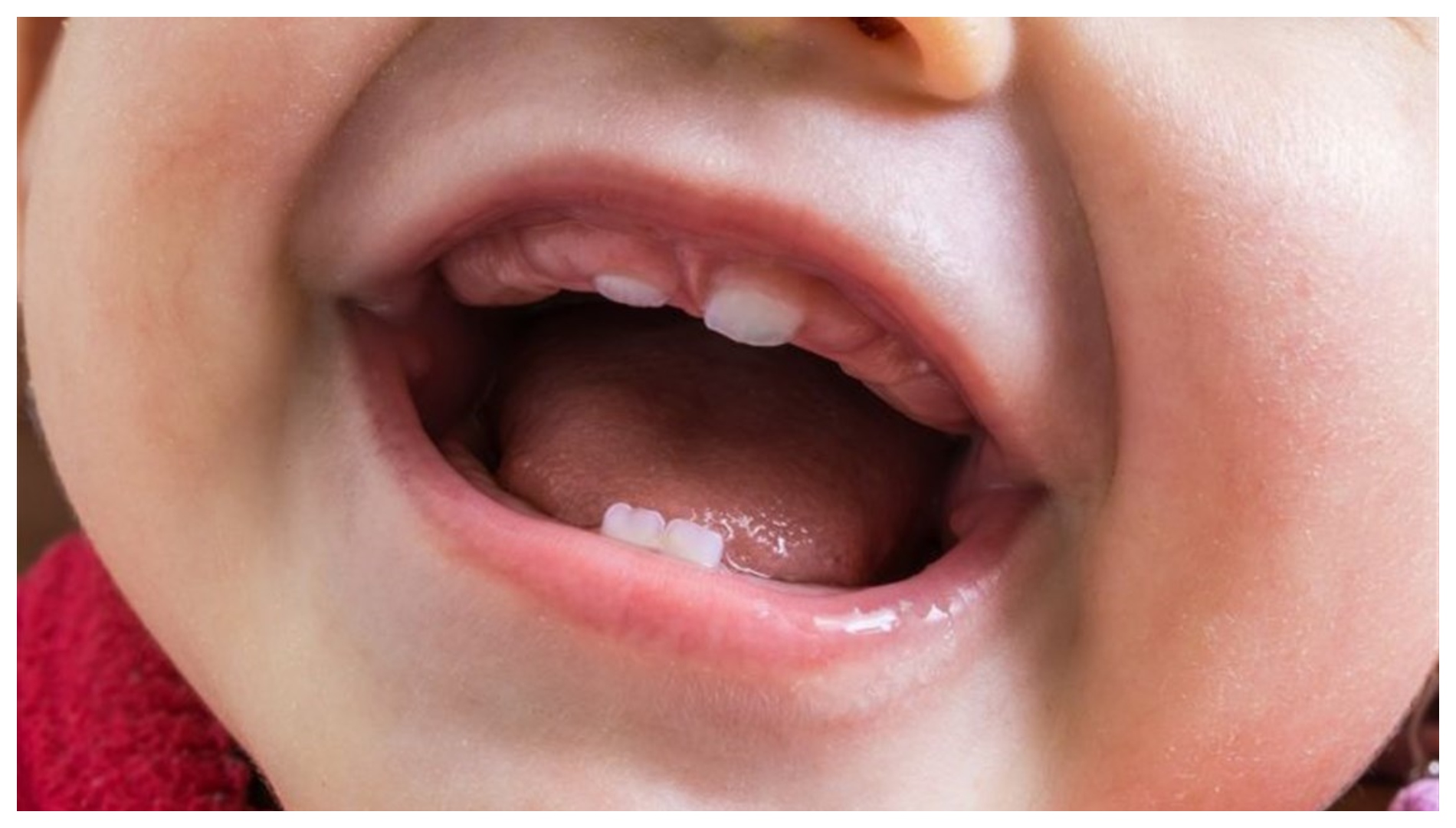 الواجهة البحرية السعر ممر  متلازمة حساسية الفم عند الأطفال.. الأعراض والأسباب ونصائح الوقاية | حلوة