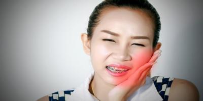 تقويم الأسنان.. نصائح لمواجهة الآلام!