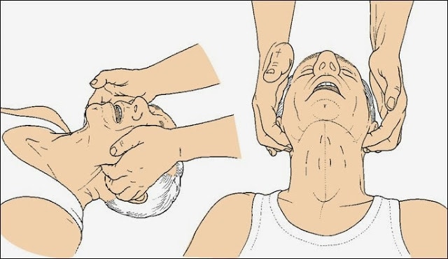 بلع اللسان
