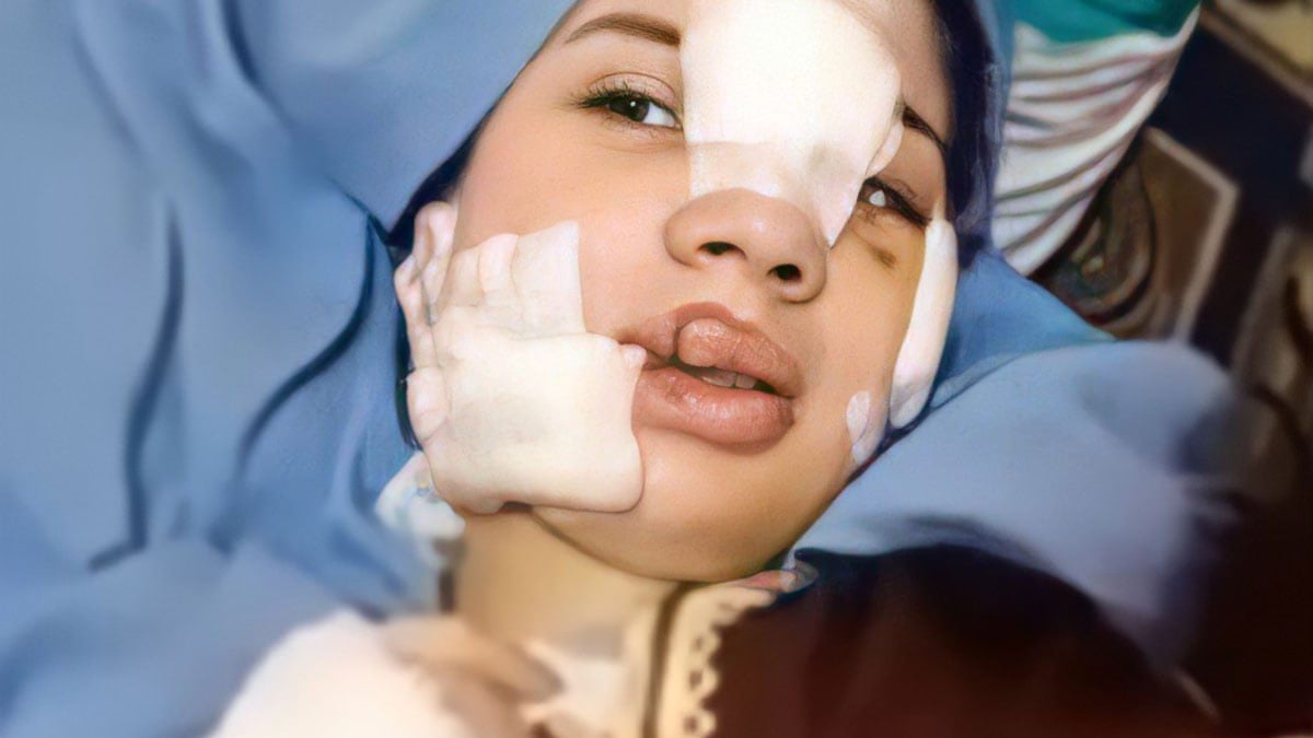 إسراء عماد