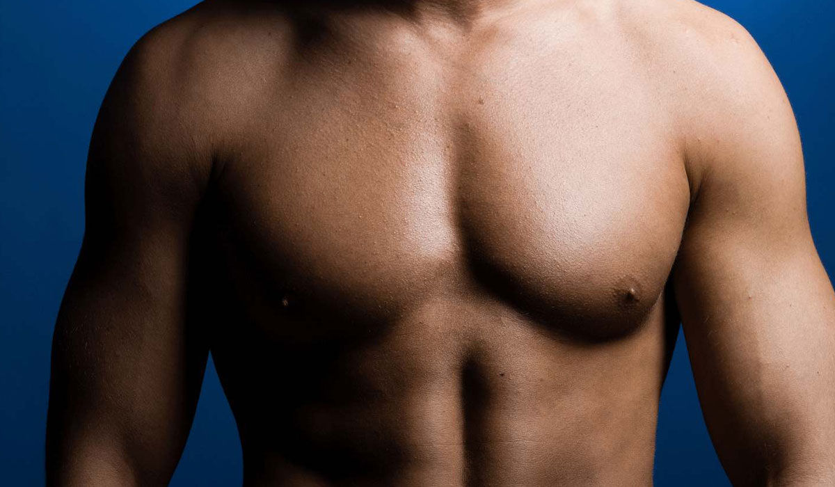 التثدي عند الرجال