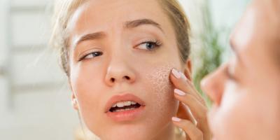 أسباب جفاف البشرة على الرغم من ترطيبها بشكل دائم