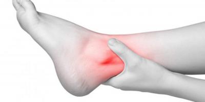 علاجات منزلية طبيعية لعلاج البروز العظمي للقدم دون جراحة