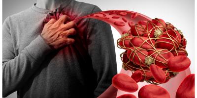 أطعمة تقلل خطر الإصابة بالنوبات القلبية وتساعد في علاج انسداد الشرايين