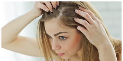علاجات منزلية فعالة للتخلص من دمامل فروة الرأس