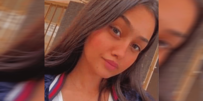 الأميرة مريم الركابي: شابة عراقية تعرضت للحرق بعد رفضها شاب.. تشوه وجهها