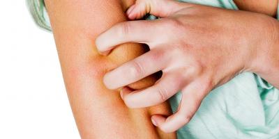 9 وصفات طبيعية للتخلص من الناموس في المنزل