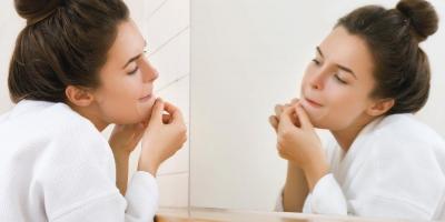 خطوات بسيطة لمنع البثور المتقرحة