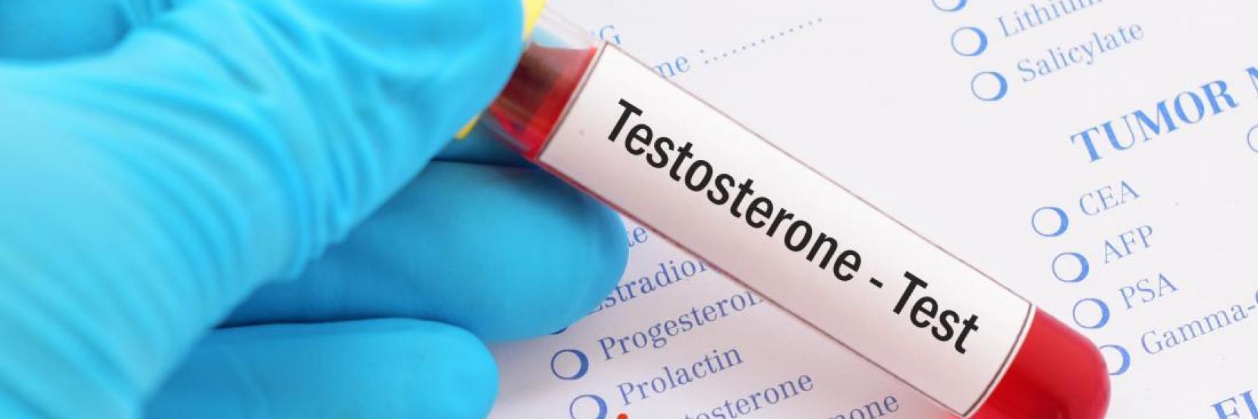 هرمون التستوستيرون
