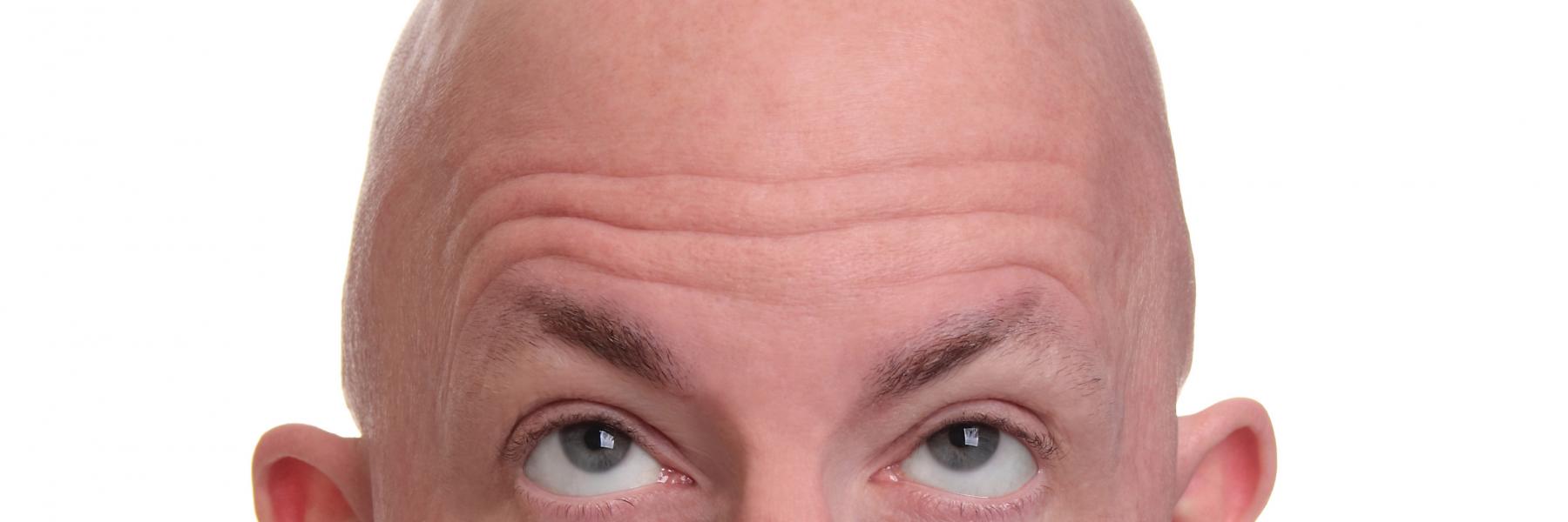 نصائح تمنع تساقط الشعر عند الرجال.. تعرف عليها