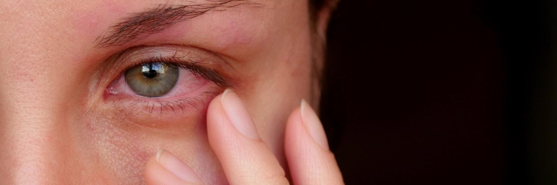 5 مشكلات للعيون تسببت  جائحة كورونا في انتشارها