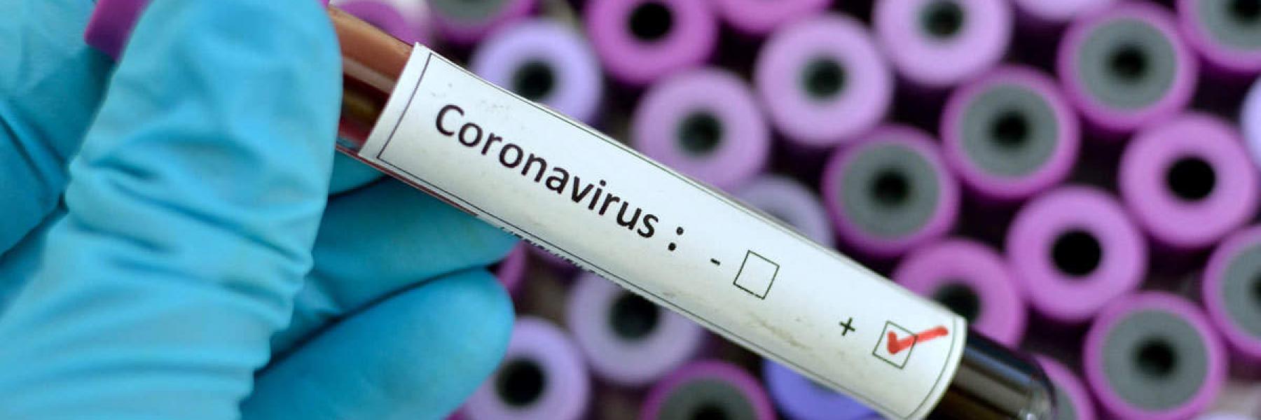 الإصابة بفيروس كورونا مرة أخرى هل يدعو للقلق؟ وماذا يعني ذلك؟