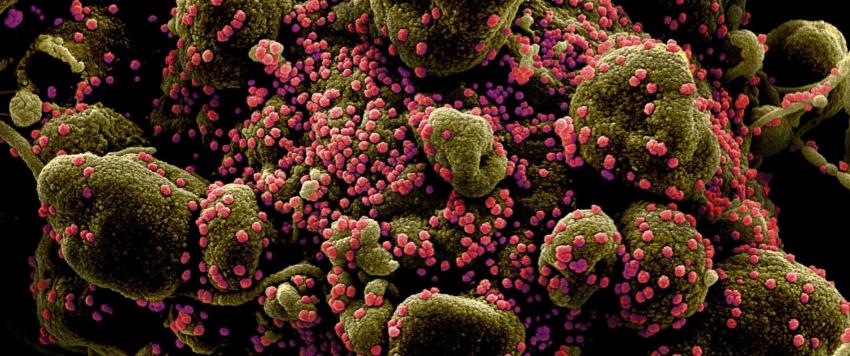 الفيروسات التاجية