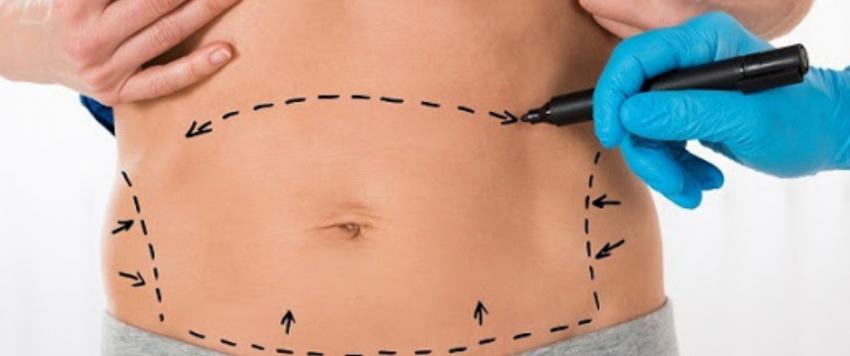 انقاص الوزن