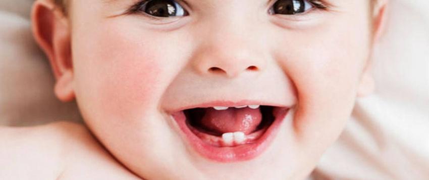 تسنين الأطفال