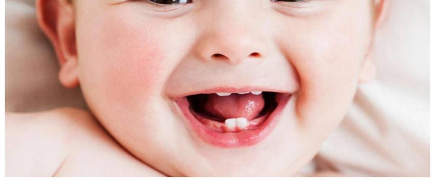 تسنين الاطفال