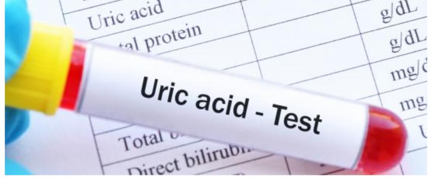 حمض اليوريك