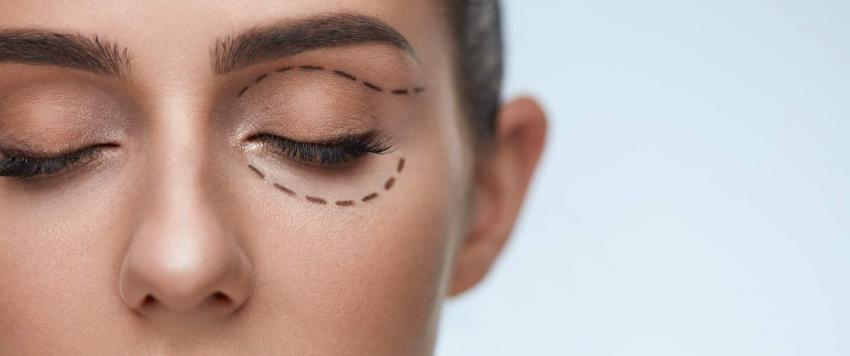 هالات سوداء