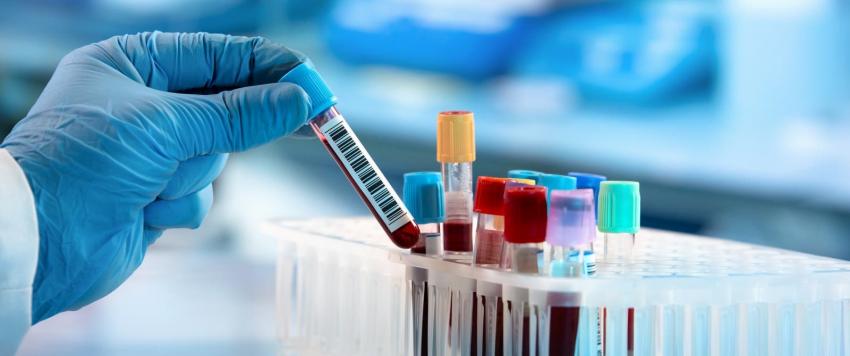 اختبار الدم