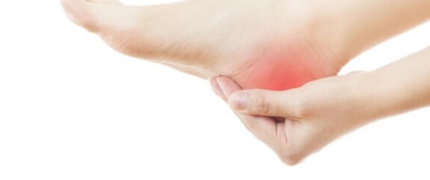 5 علاجات منزلية لعلاج مسمار القدم