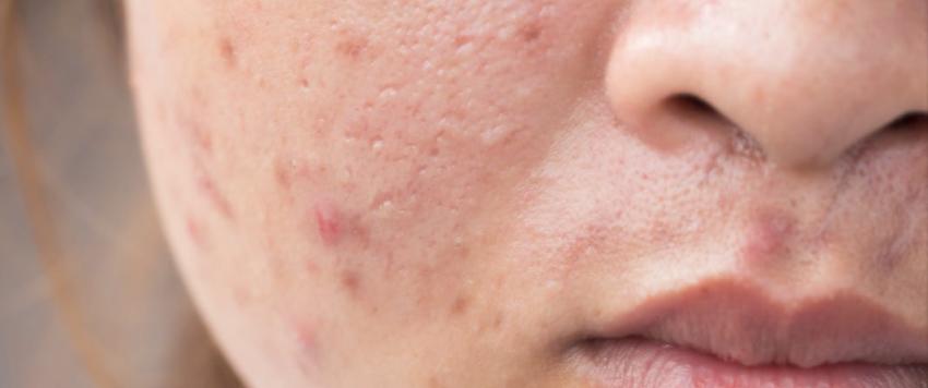 إليكِ ما يكشفه موقعها عن صحتك