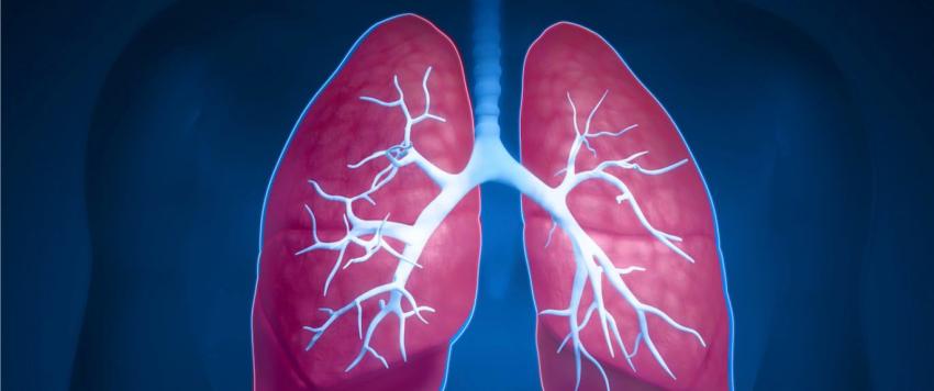 سرطان الرئة