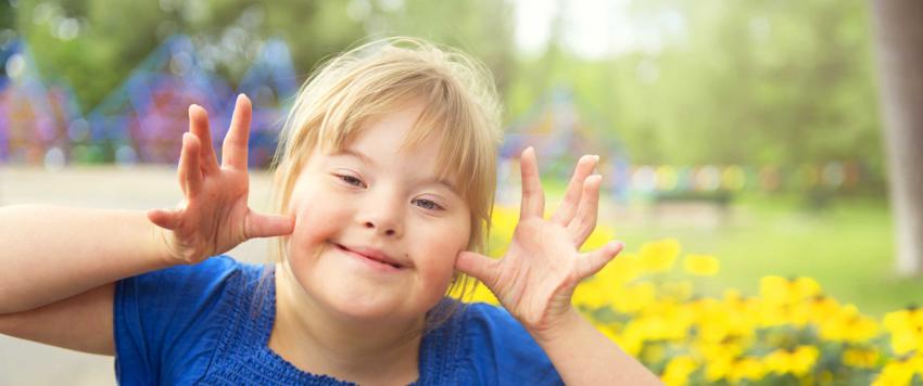 متلازمة داون