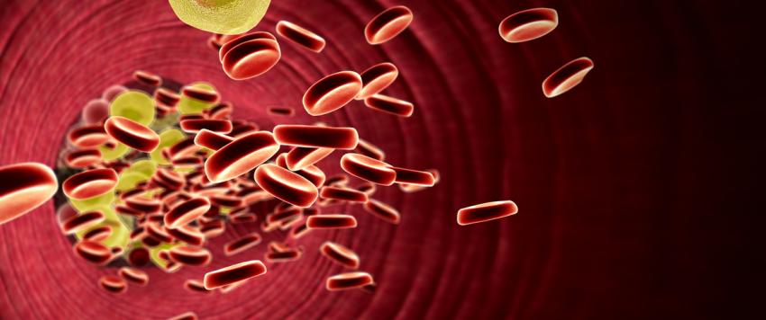 7 علاجات طبيعية لارتفاع نسبة الكوليسترول في الدم