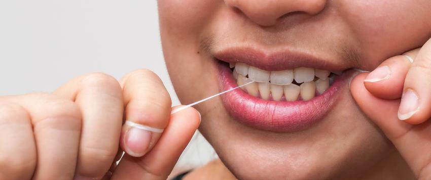 تنظيف الأسنان بالخيط