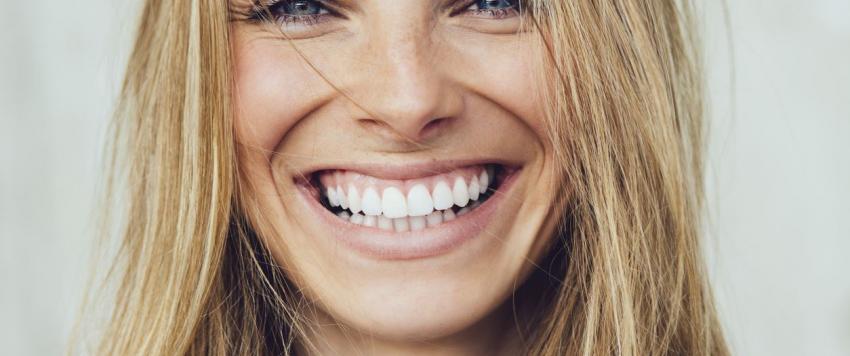 تبييض الأسنان