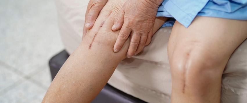 آلام الركبة