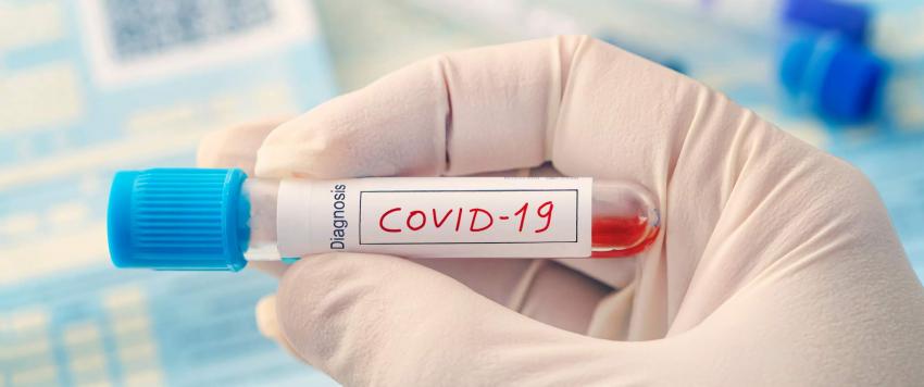 خاتم ذكي يكشف لمرتديه إذا ما كان مصابًا بفيروس كورونا!