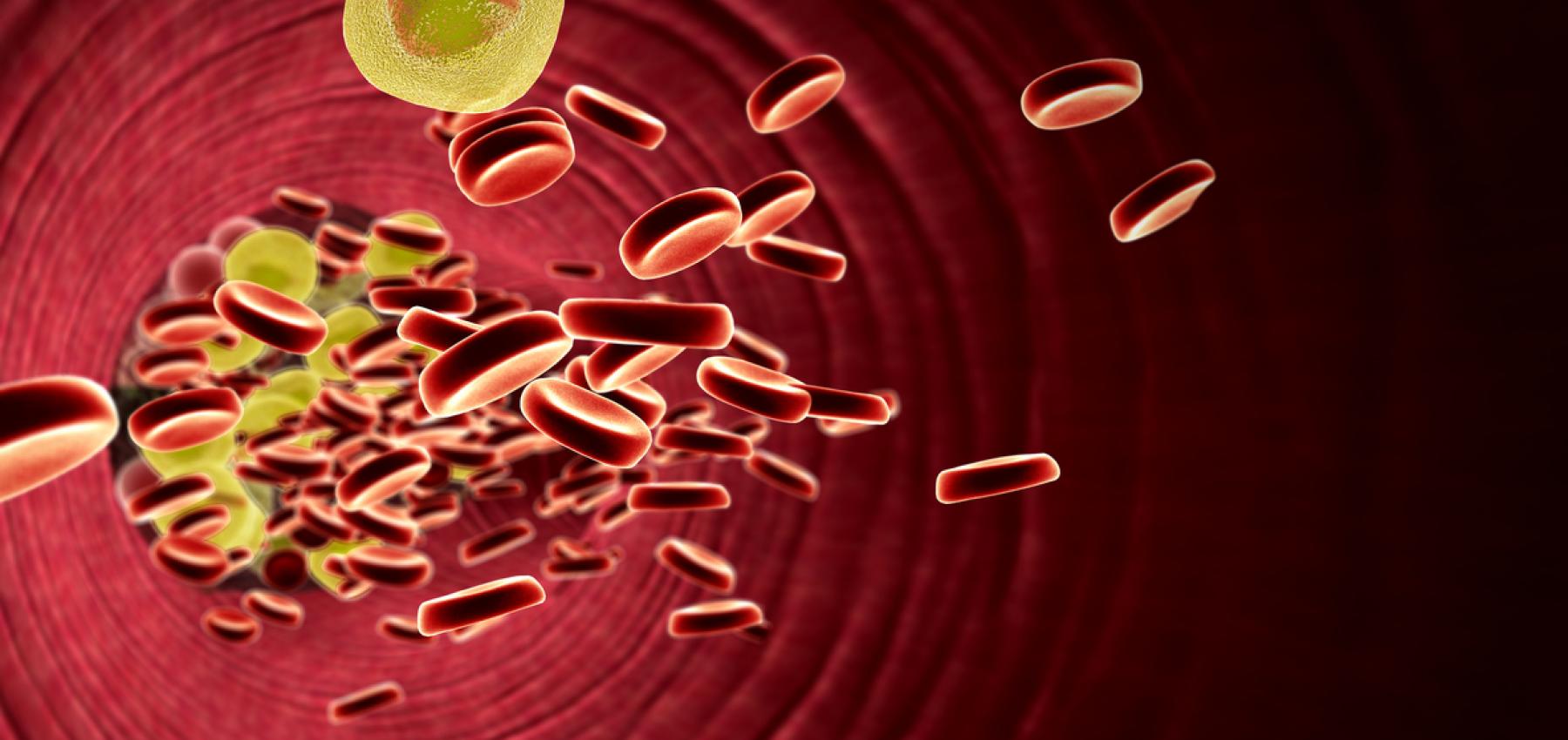 7 علاجات طبيعية لارتفاع نسبة الكوليسترول في الدم