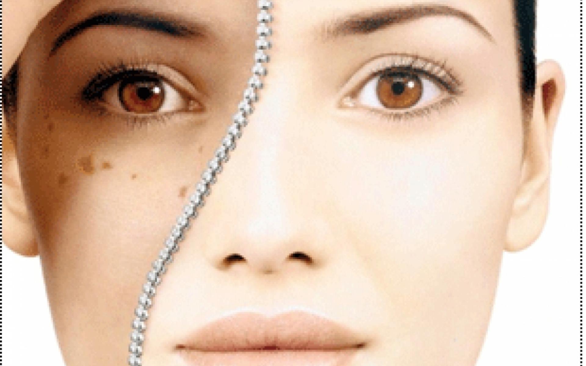 3- تبييض لبشرة الجلد: تتكون الفراولة من فيتامين ج الذي يعمل على تبييض البشرة بفاعلية، وجعلها بشرة نضرة وسلسة، وتحتوي الفراولة أيضاً على حمض الماليك، الذي يساعد على تبييض الشفاه وجعلها بشرة رطبة وفاتحة اللون.